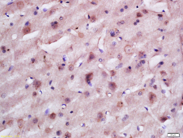 TACO1 Antibody in Immunohistochemistry (Paraffin) (IHC (P))