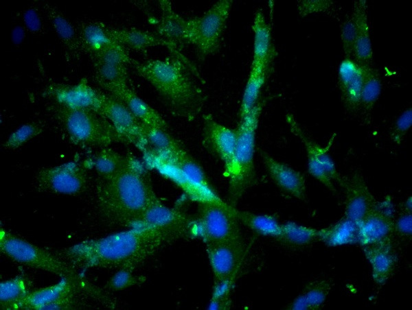 Cathepsin D/CTSD Antibody in Immunocytochemistry (ICC/IF)