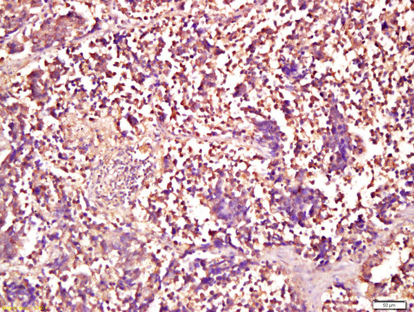Smad1 + Smad5 Antibody in Immunohistochemistry (Paraffin) (IHC (P))