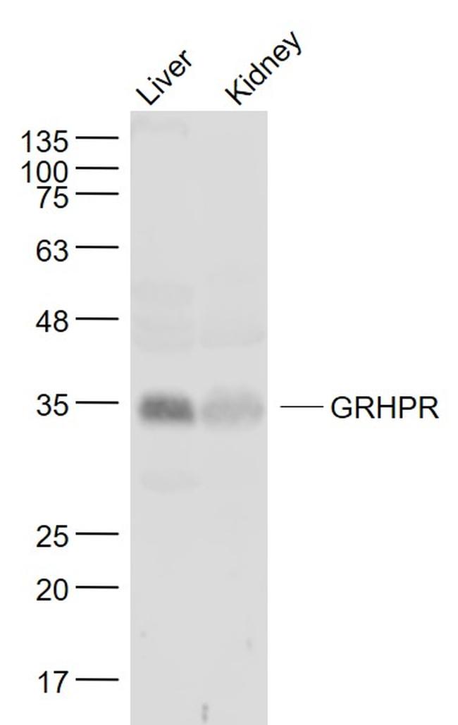 GRHPR Antibody in Western Blot (WB)