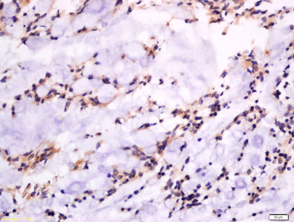 GSDMA Antibody in Immunohistochemistry (Paraffin) (IHC (P))