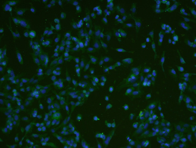 ATF6 Antibody in Immunocytochemistry (ICC/IF)