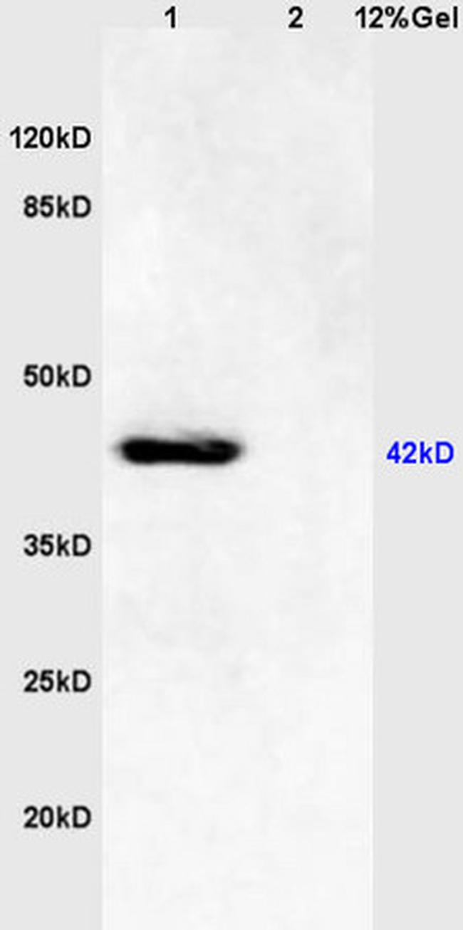Phospho-JNK1/2/3 (Thr183, Tyr185) Antibody in Western Blot (WB)