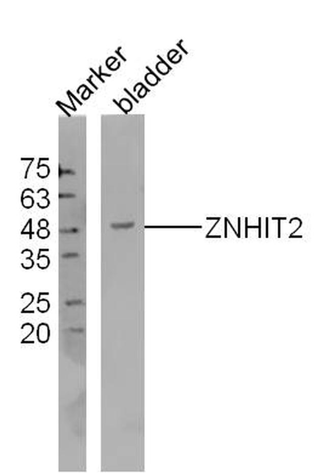 ZNHIT2 Antibody in Western Blot (WB)