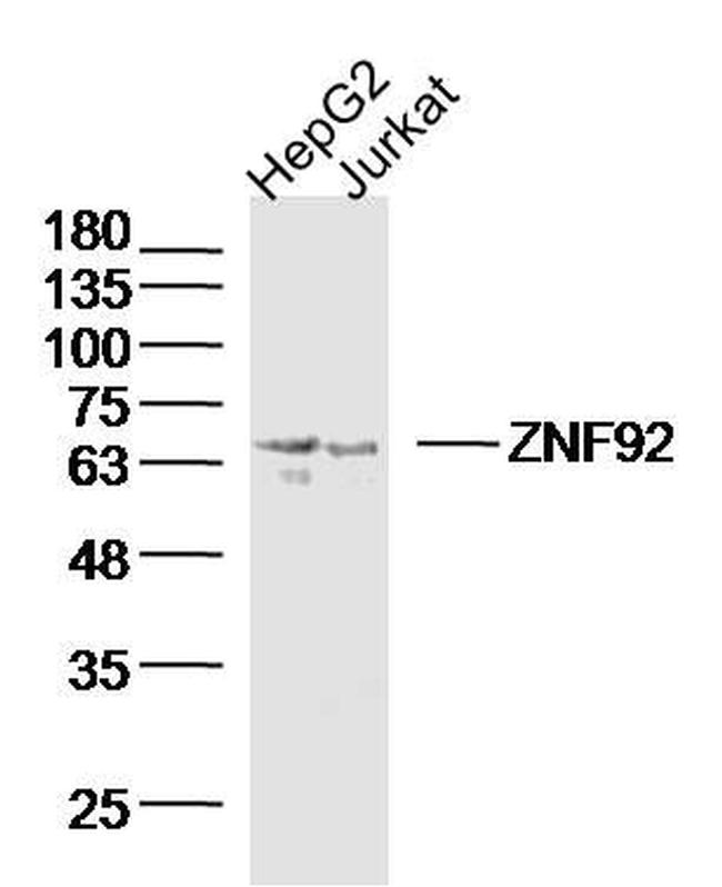 ZNF92 Antibody in Western Blot (WB)