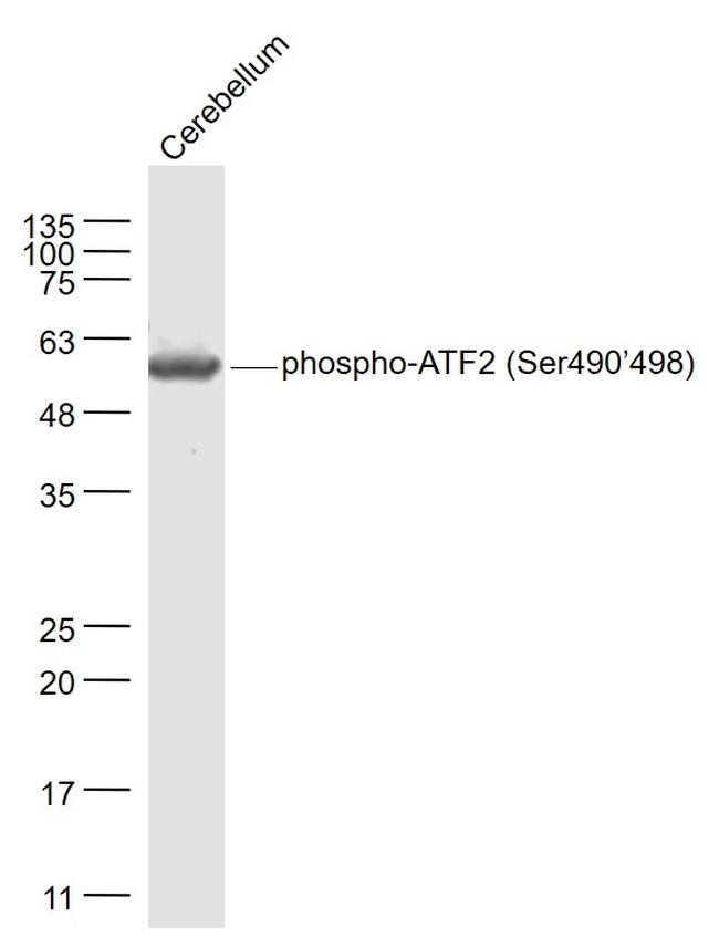 Phospho-ATF2 (Ser490, Ser498) Antibody in Western Blot (WB)