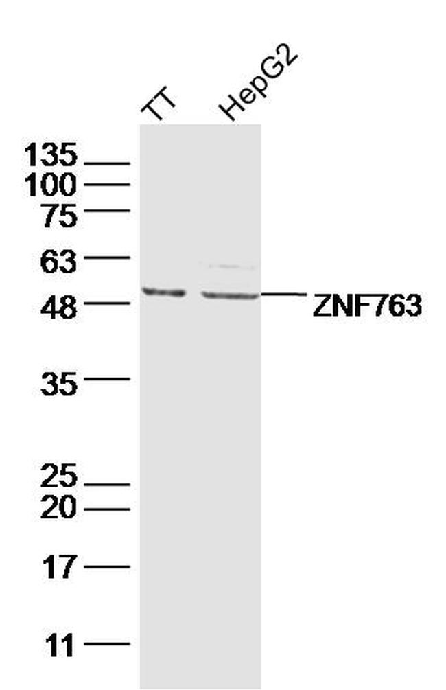 ZNF763 Antibody in Western Blot (WB)