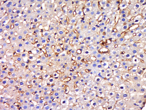 HIATL1 Antibody in Immunohistochemistry (Paraffin) (IHC (P))