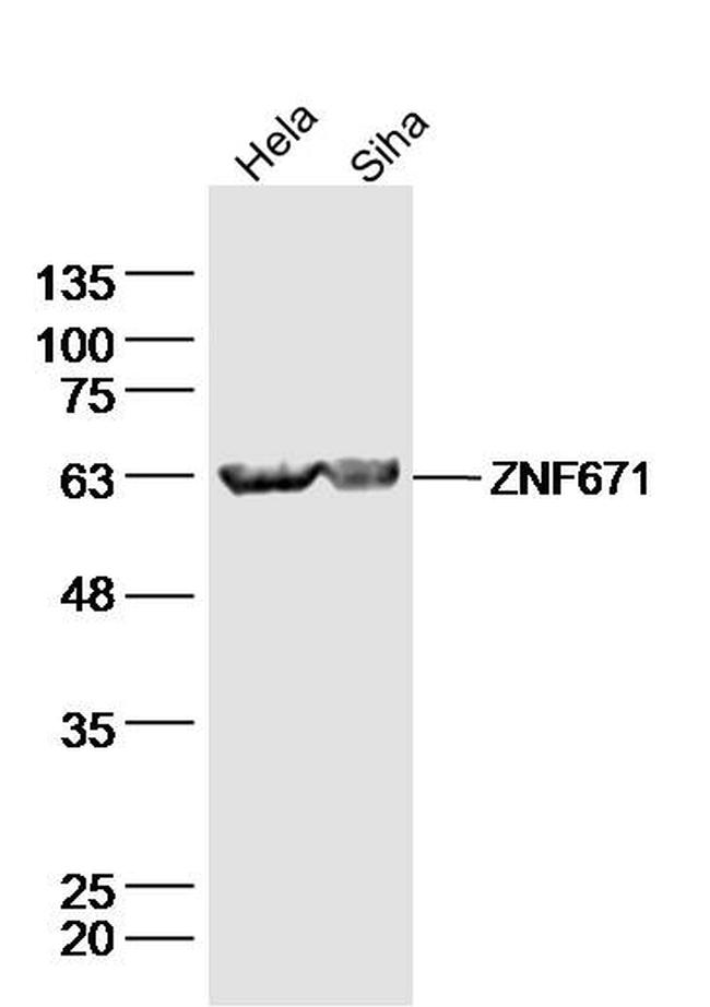 ZNF671 Antibody in Western Blot (WB)