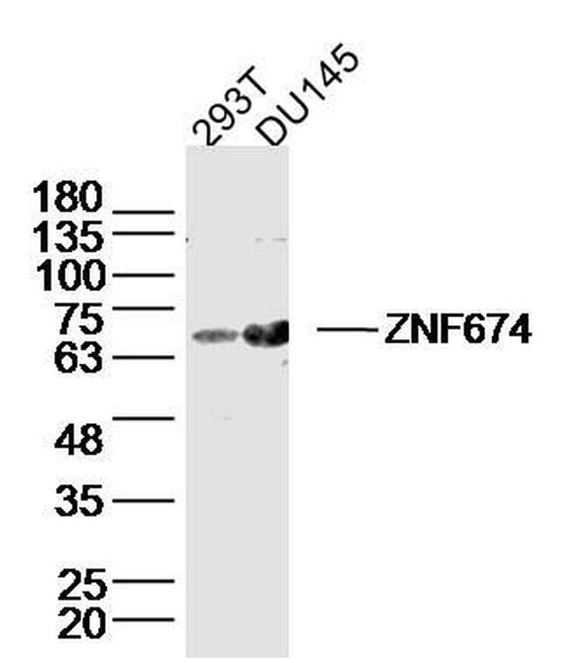 ZNF674 Antibody in Western Blot (WB)