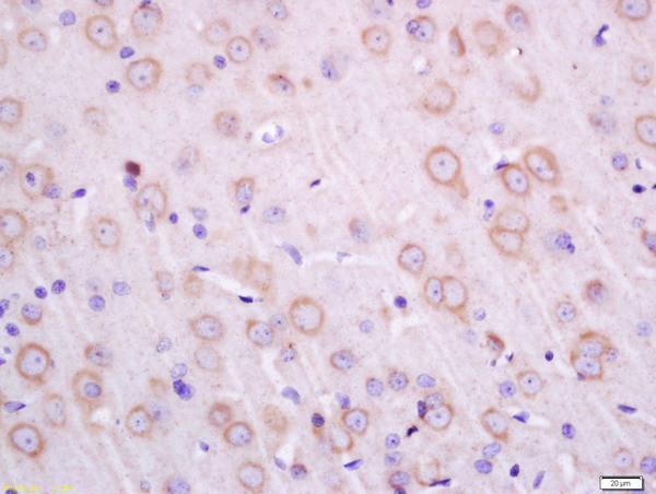 Transmembrane protein 30A Antibody in Immunohistochemistry (Paraffin) (IHC (P))
