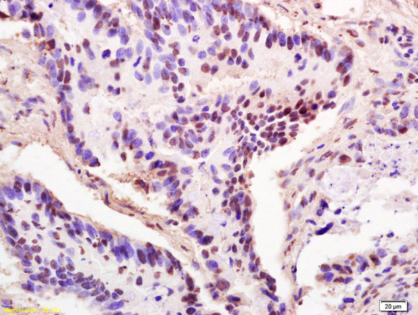 THOC2 Antibody in Immunohistochemistry (Paraffin) (IHC (P))