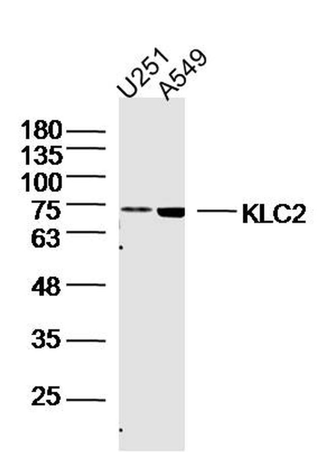 KLC2 Antibody in Western Blot (WB)