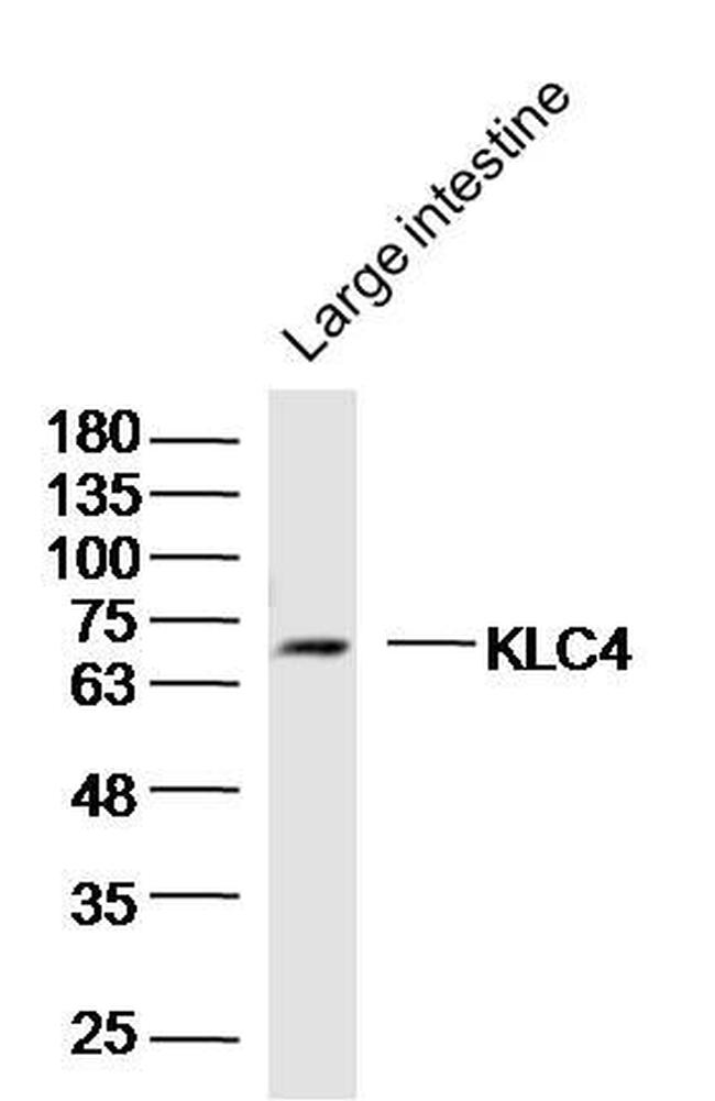 KLC4 Antibody in Western Blot (WB)
