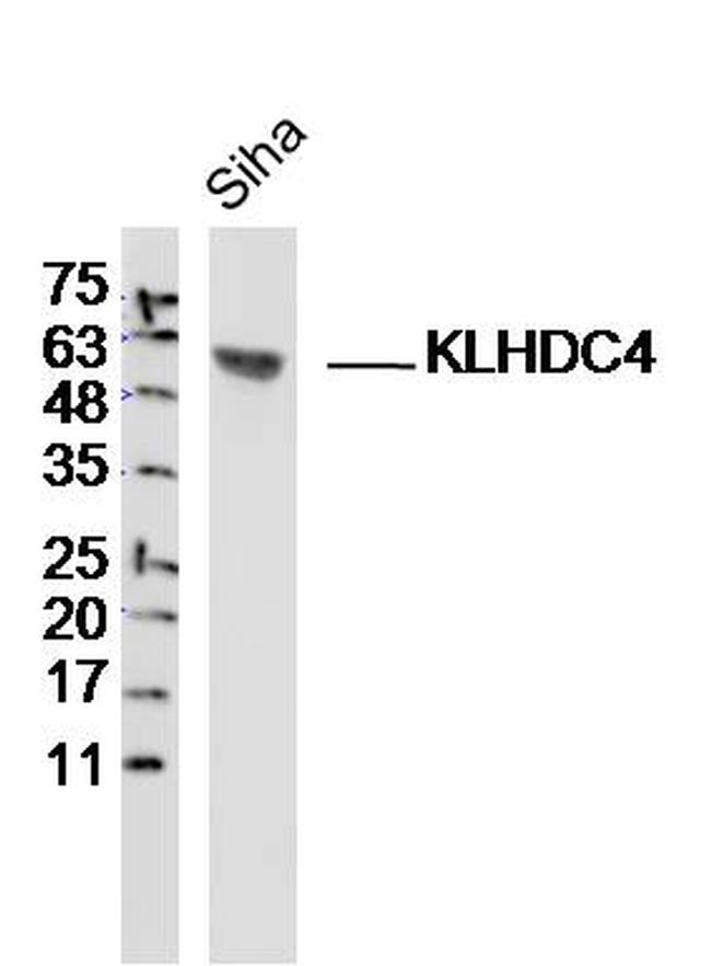 KLHDC4 Antibody in Western Blot (WB)