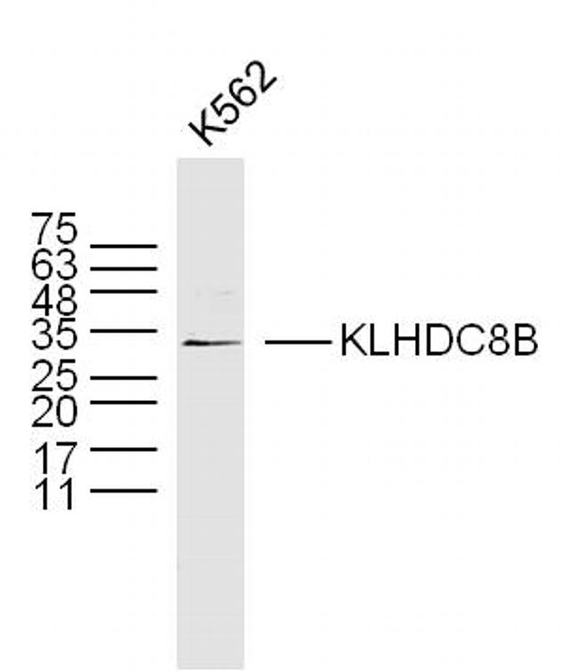 KLHDC8B Antibody in Western Blot (WB)