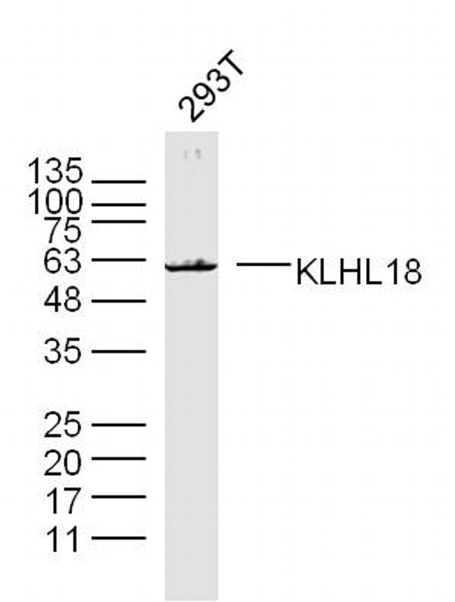 KLHL18 Antibody in Western Blot (WB)