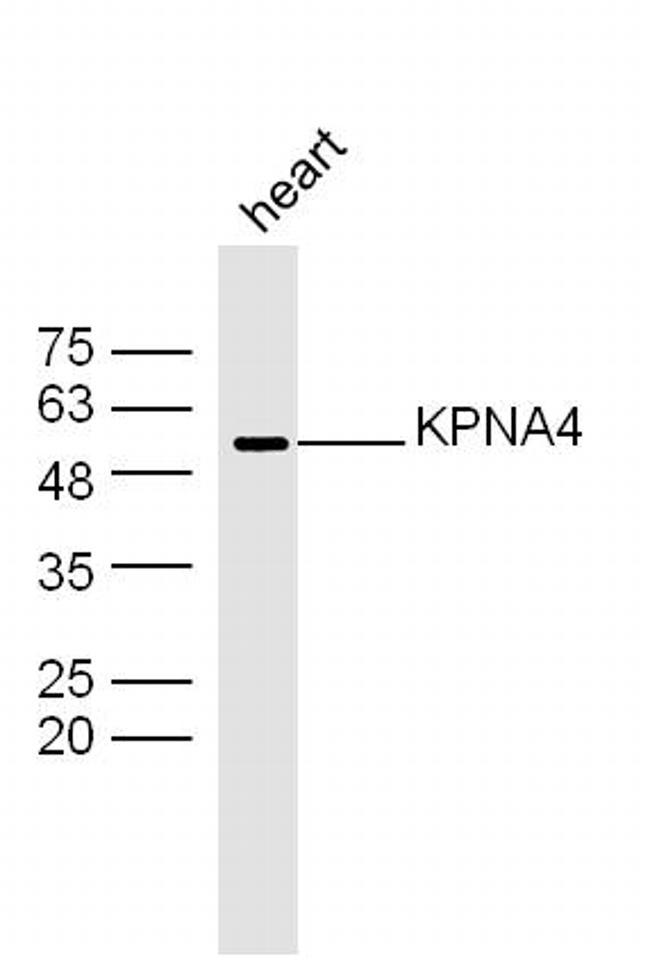 KPNA4 Antibody in Western Blot (WB)
