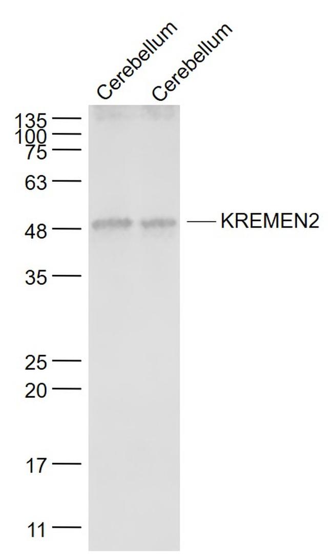 KREMEN2 Antibody in Western Blot (WB)