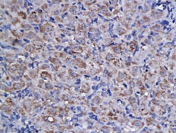 Cyclin F Antibody in Immunohistochemistry (Paraffin) (IHC (P))