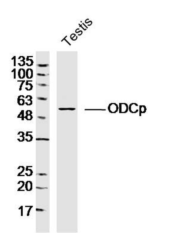 ODCp Antibody in Western Blot (WB)