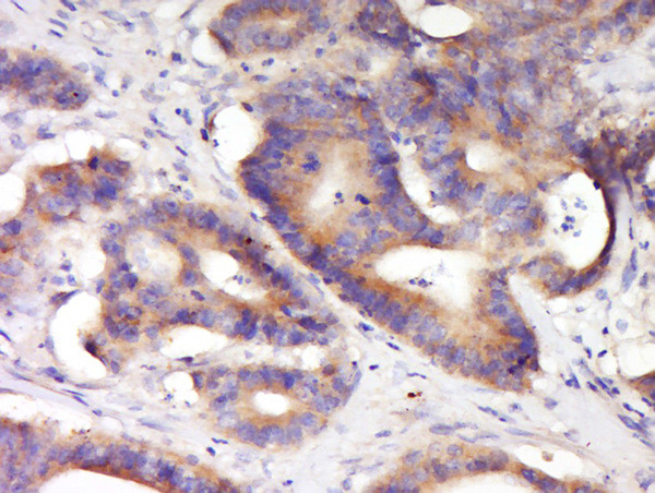 KCNV2 Antibody in Immunohistochemistry (Paraffin) (IHC (P))