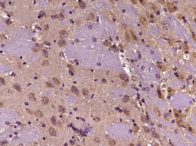 KCTD17 Antibody in Immunohistochemistry (Paraffin) (IHC (P))