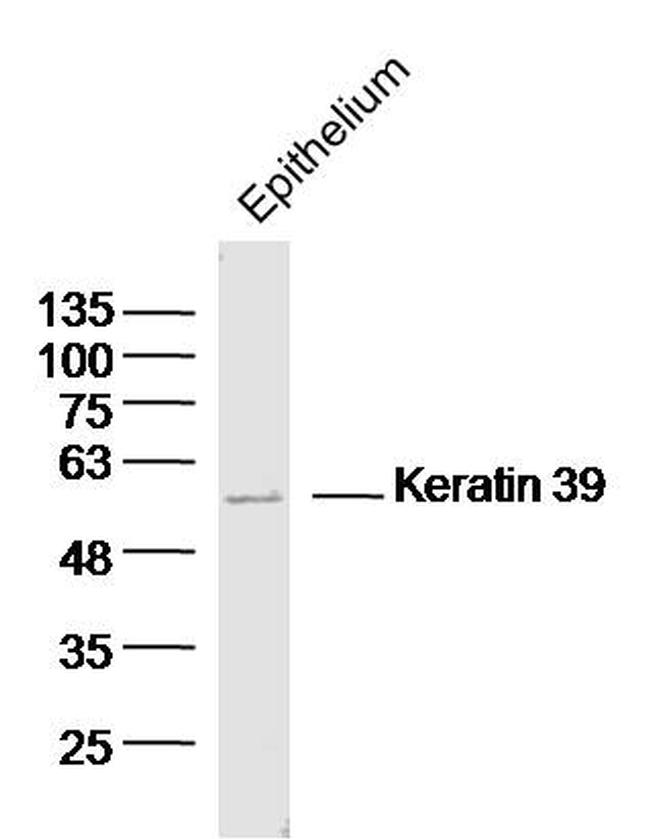 Keratin 39 Antibody in Western Blot (WB)