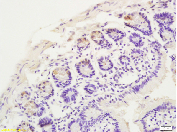 CCR10 Antibody in Immunohistochemistry (Paraffin) (IHC (P))