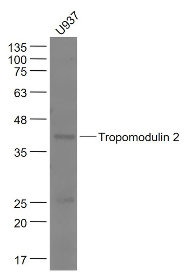 Tropomodulin 2 Antibody in Western Blot (WB)