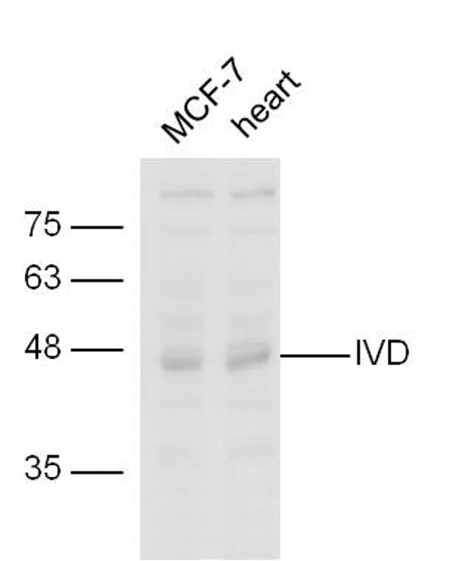 IVD Antibody in Western Blot (WB)