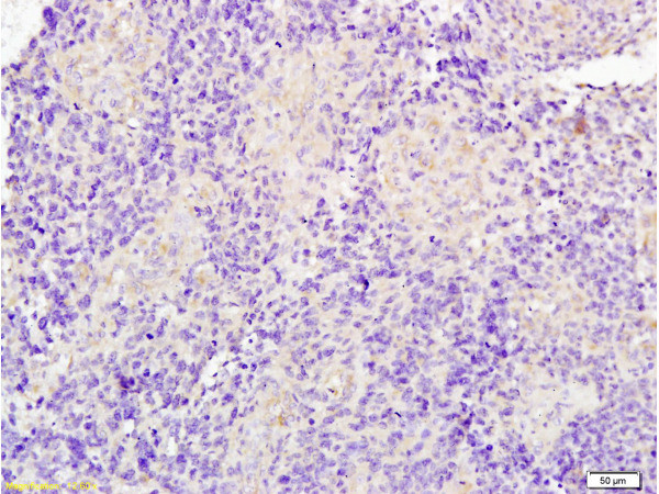 JUP/gamma Catenin Antibody in Immunohistochemistry (Paraffin) (IHC (P))