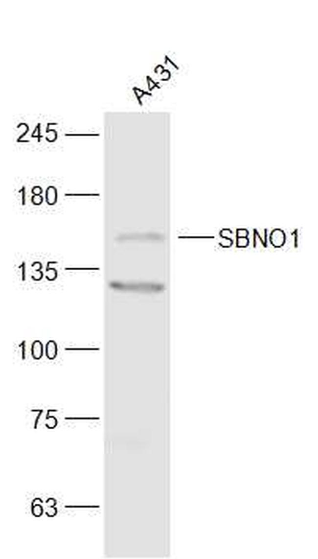 SBNO1 Antibody in Western Blot (WB)