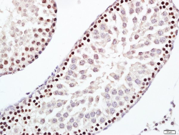 ERCC1 Antibody in Immunohistochemistry (Paraffin) (IHC (P))