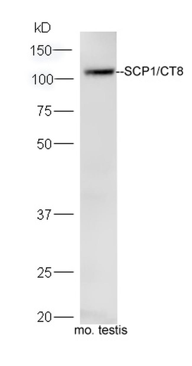 SCP1 Antibody in Western Blot (WB)
