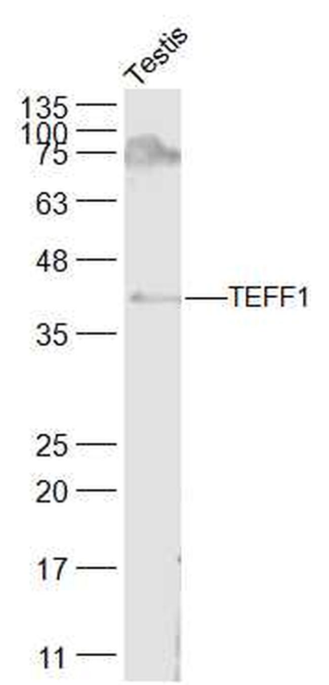 TEFF1 Antibody in Western Blot (WB)