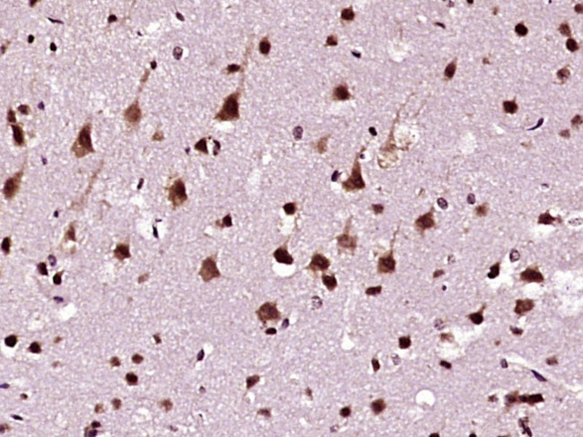 hnRNP DL Antibody in Immunohistochemistry (Paraffin) (IHC (P))