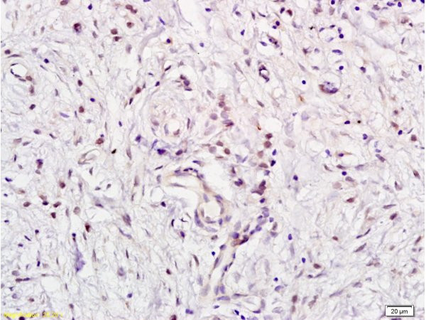 E2F5 Antibody in Immunohistochemistry (Paraffin) (IHC (P))
