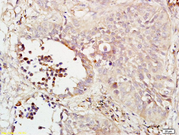 Phospho-MEK1/MAPKK1 (Ser298) Antibody in Immunohistochemistry (Paraffin) (IHC (P))