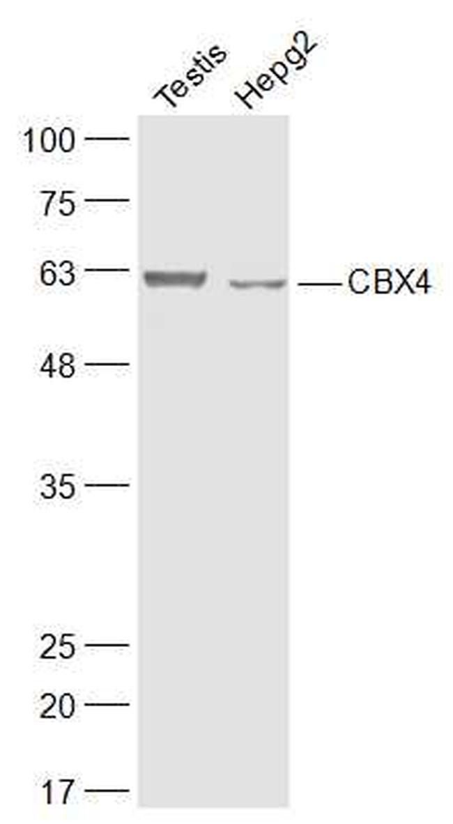 CBX4 Antibody in Western Blot (WB)