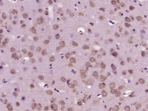 HPS5 Antibody in Immunohistochemistry (Paraffin) (IHC (P))