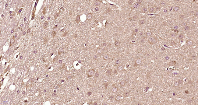 DRD3 Antibody in Immunohistochemistry (Paraffin) (IHC (P))