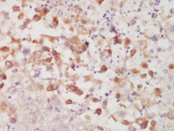 CK7 Antibody in Immunohistochemistry (Paraffin) (IHC (P))