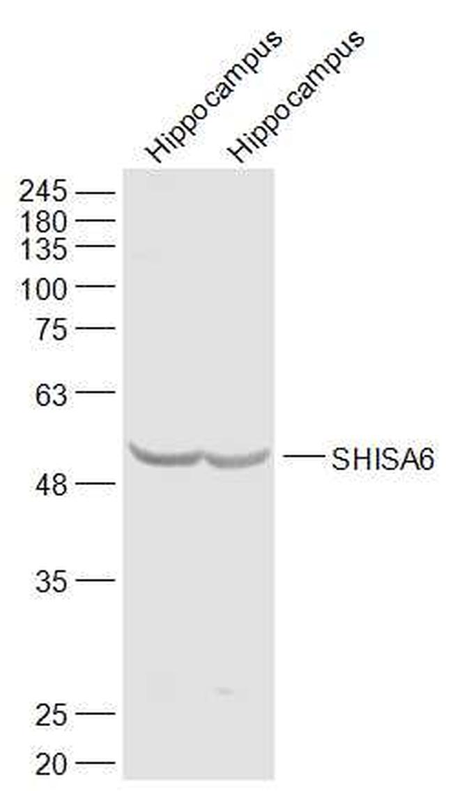 SHISA6 Antibody in Western Blot (WB)