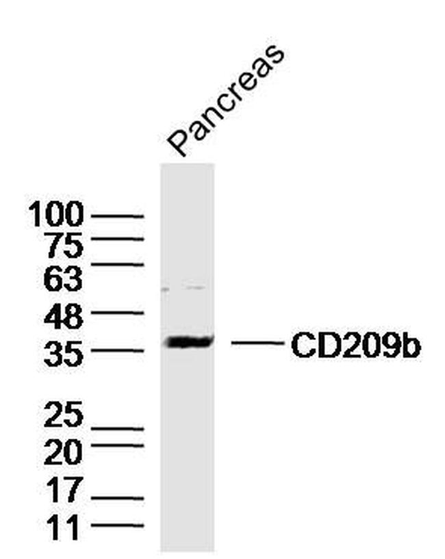 CD209b Antibody in Western Blot (WB)