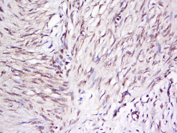 OTUD5 Antibody in Immunohistochemistry (Paraffin) (IHC (P))