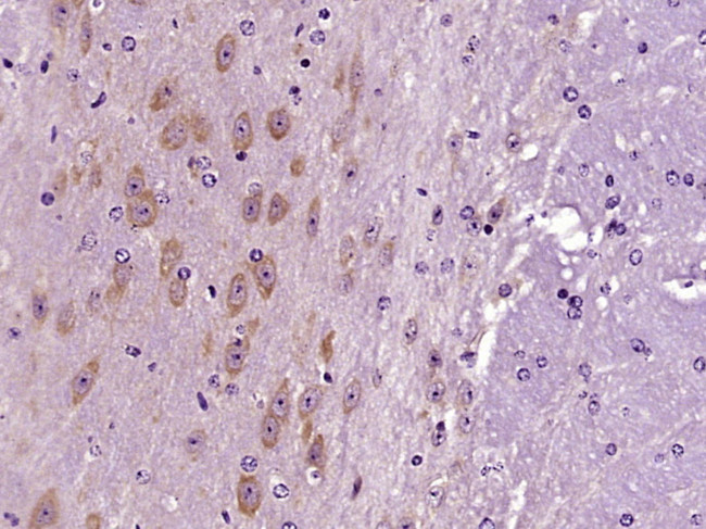 OTUD6B Antibody in Immunohistochemistry (Paraffin) (IHC (P))