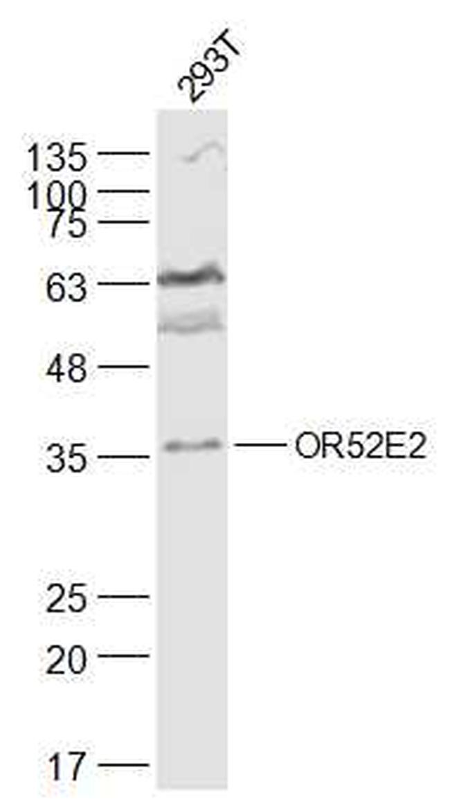 OR52E2 Antibody in Western Blot (WB)