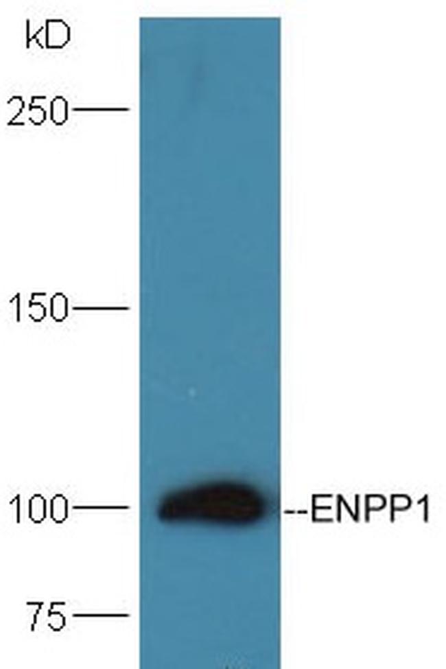 ENPP1/PC1/3 Antibody in Western Blot (WB)