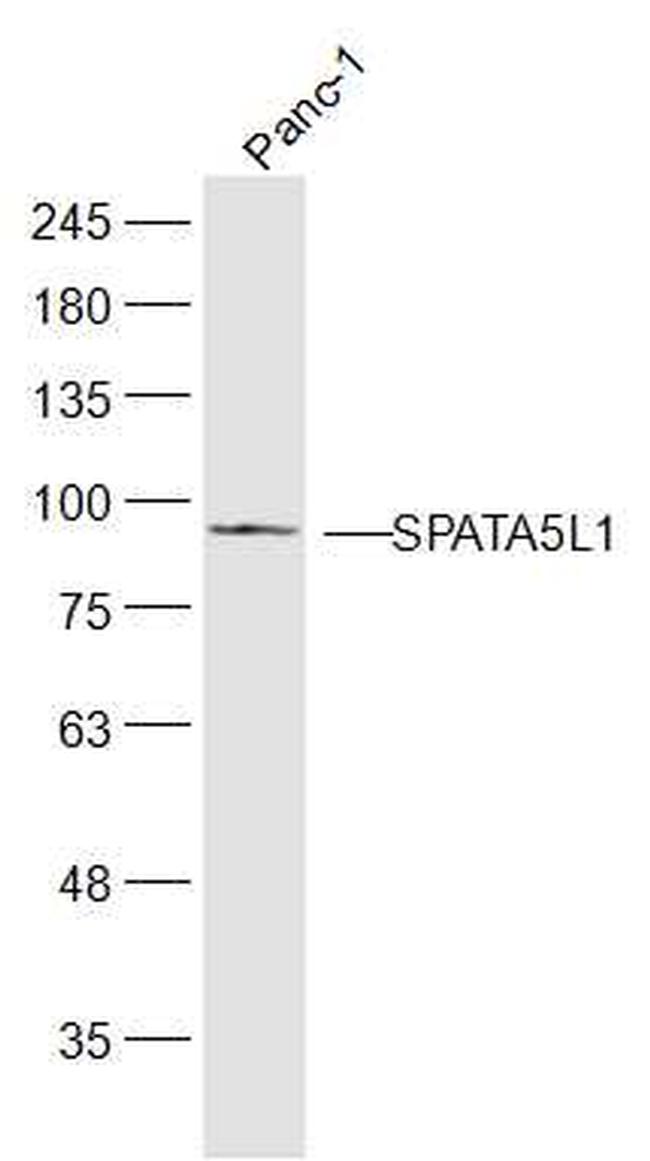 SPATA5L1 Antibody in Western Blot (WB)